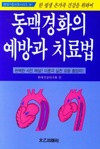 동맥경화의 예방과 치료법(현대가정의학시리즈 29)