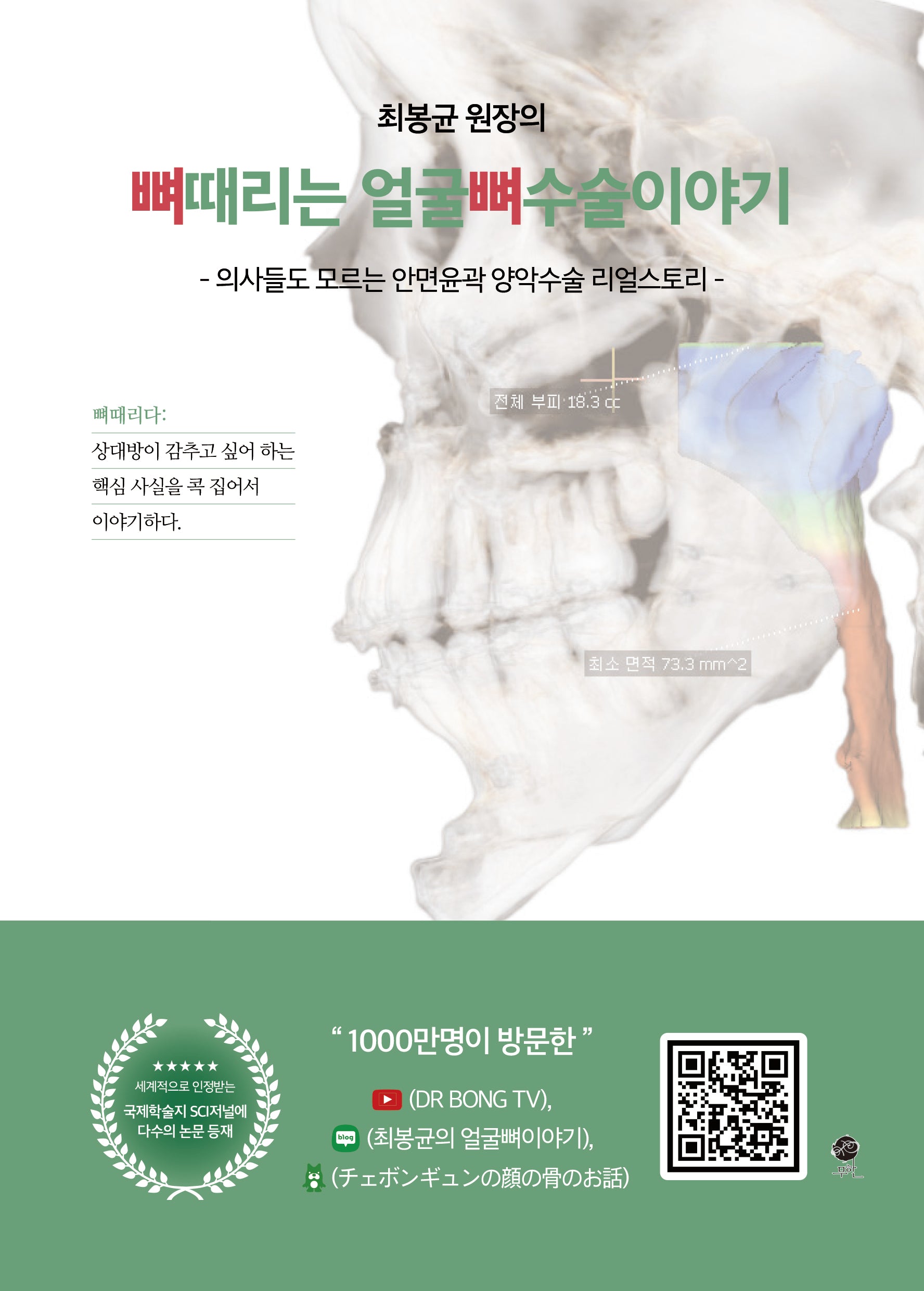 뼈때리는 얼굴뼈수술 이야기(최봉균 원장의)