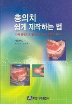 총의치 쉽게 제작하는 법