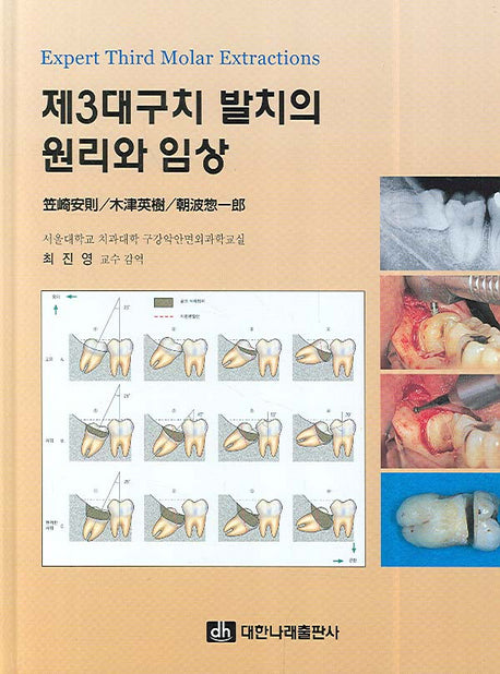 제3대구치 발치의 원리와 임상(양장본 Hardcover)