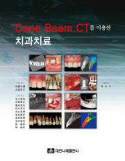 Cone Beam CT를 이용한 치과치료
