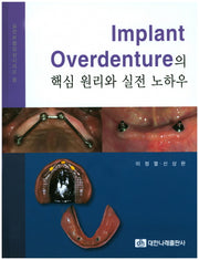 Implant Overdenture의 핵심 원리와 실전 노하우(실전보철임상시리즈 2)(양장본 Hardcover)