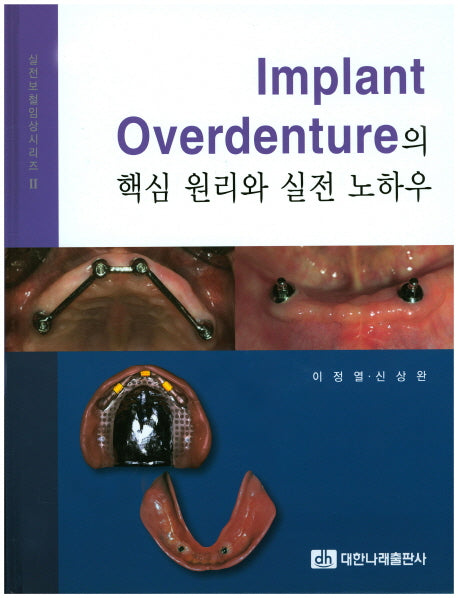 Implant Overdenture의 핵심 원리와 실전 노하우(실전보철임상시리즈 2)(양장본 Hardcover)