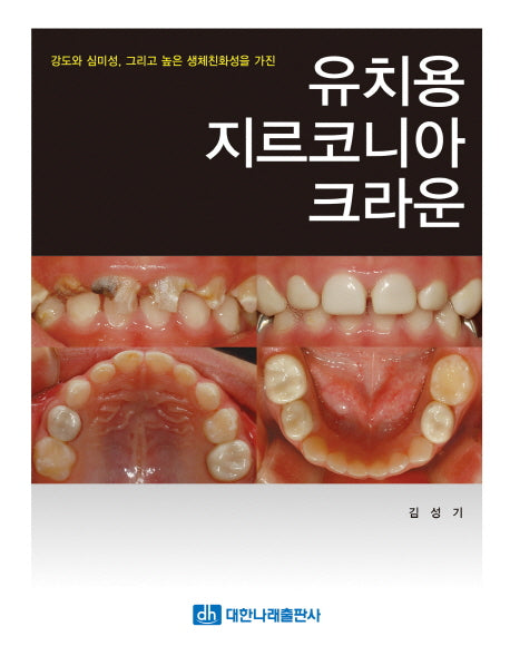 유치용 지르코니아 크라운(양장본 Hardcover)