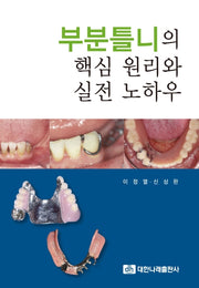부분틀니의 핵심 원리와 실전 노하우(실전 보철 임상 시리즈 3)