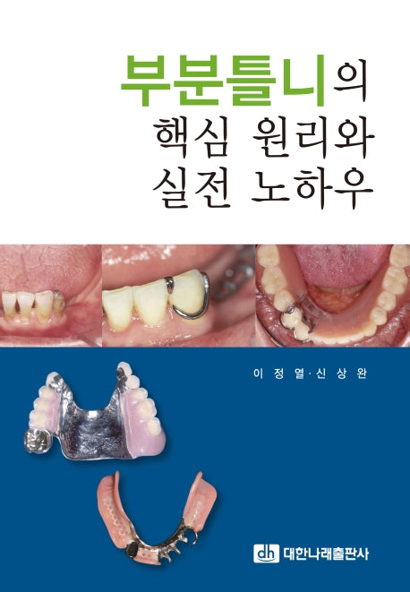 부분틀니의 핵심 원리와 실전 노하우(실전 보철 임상 시리즈 3)