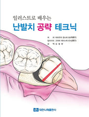 난발치 공략 테크닉(일러스트로 배우는)