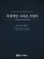 독창적인 크라운 브릿지