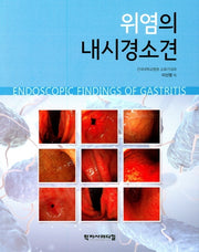 위염의 내시경 소견