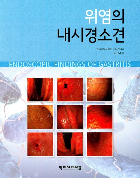 위염의 내시경 소견