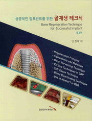 골재생 테크닉(제2편)(성공적인 임프란트를 위한)