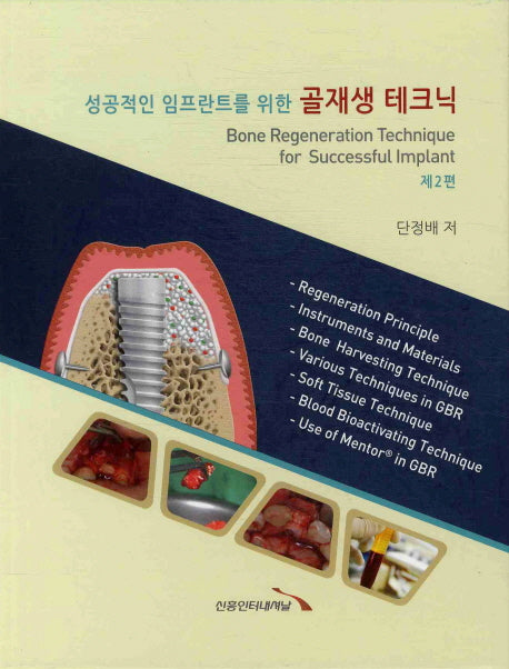 골재생 테크닉(제2편)(성공적인 임프란트를 위한)