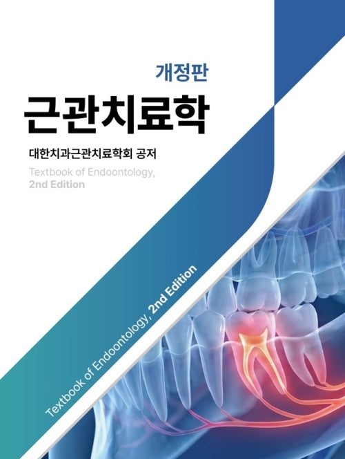 근관치료학(개정판)
