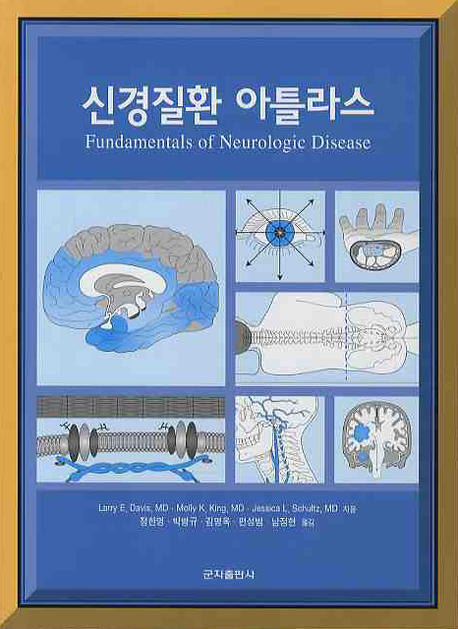 신경질환 아틀라스