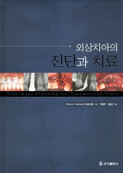 외상치아의 진단과 치료(양장본 HardCover)