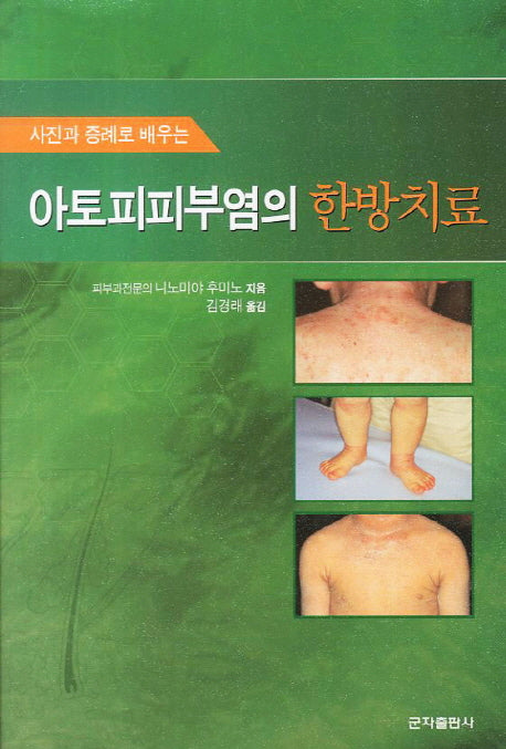 아토피피부염의 한방치료(사진과 증례로 배우는)