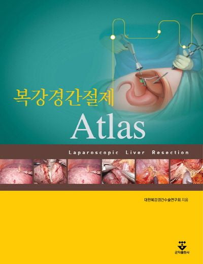 복강경간절제 Atlas