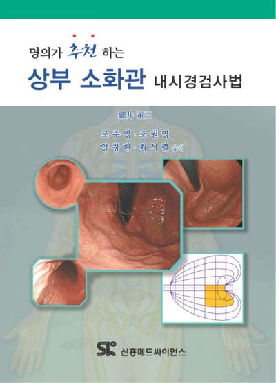 상부 소화관 내시경검사법(명의가 추천하는)