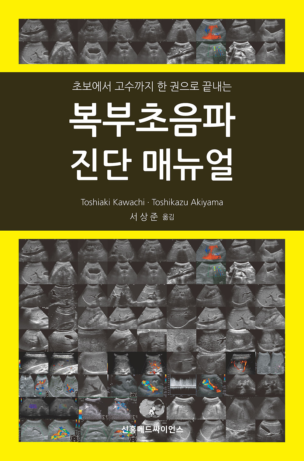 복부초음파 진단 매뉴얼(초보에서 고수까지 한 권으로 끝내는)