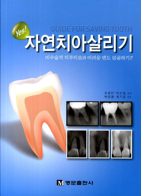 자연치아살리기(Yes)