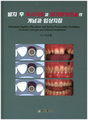 발치 후 즉시식립과 발치와보존술의 개념과 임상지침(양장본 HardCover)