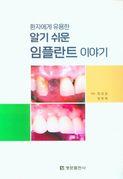 알기 쉬운 임플란트 이야기(환자에게 유용한)