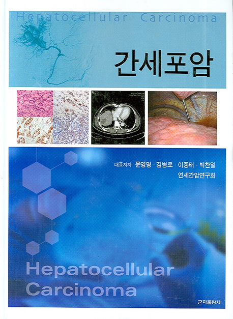 간세포암(양장본 HardCover)