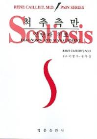 척추측만