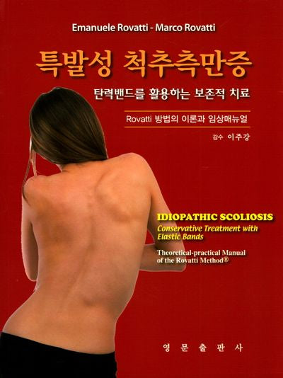 특발성 척추측만증