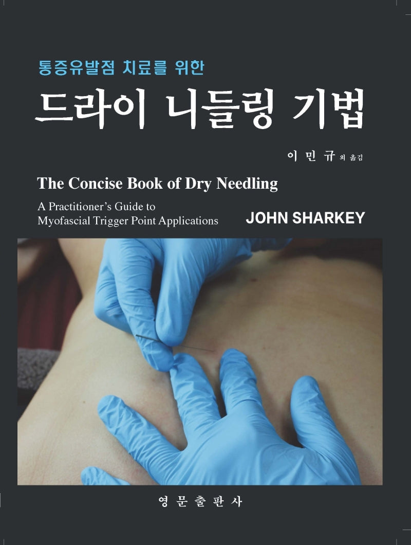 드라이 니들링 기법(통증유발점 치료를 위한)
