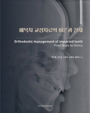 매복치 교정치료의 이론과 실제