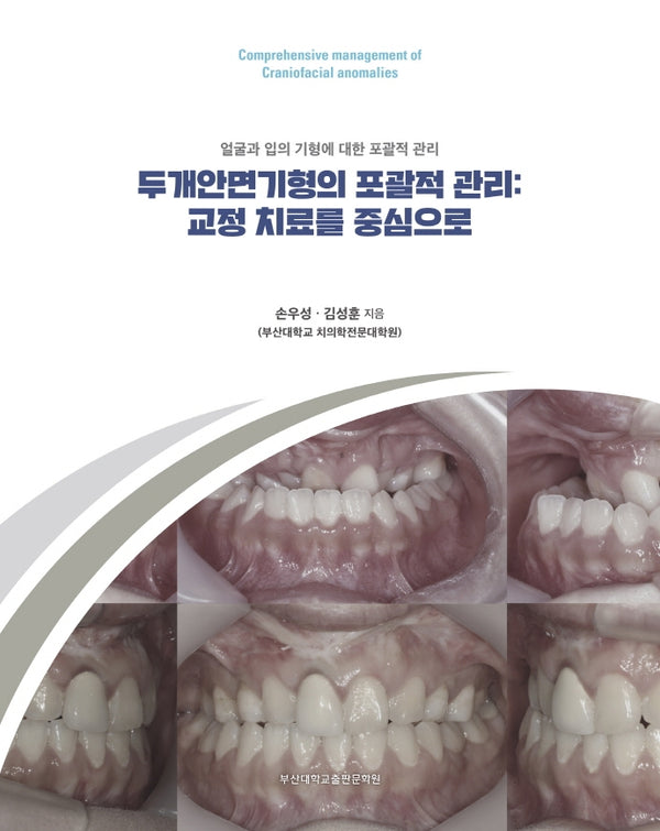 두개안면기형의 포괄적 관리: 교정 치료를 중심으로