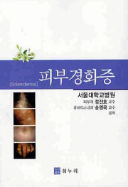 피부경화증