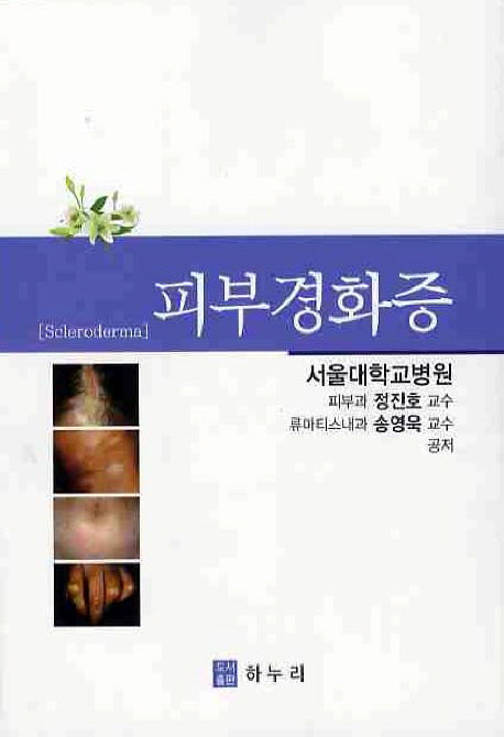 피부경화증