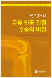 난쟁이의 무릎 인공 관절 수술의 비결
