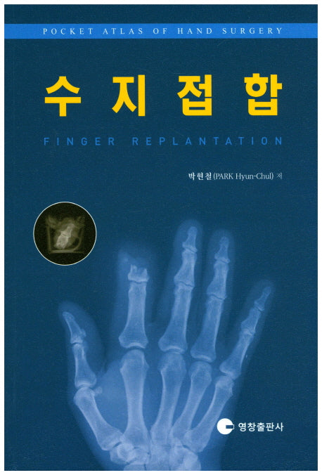 수지접합