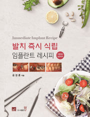 발치 즉시 식립 임플란트 레시피