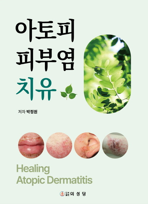 아토피 피부염 치유(양장본 Hardcover)