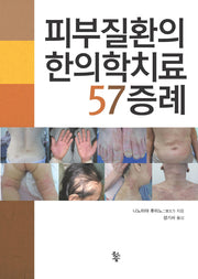 피부질환의 한의학치료 57증례