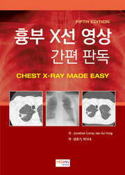 흉부 X선 영상 간편 판독(Chest X-Ray Made Easy)