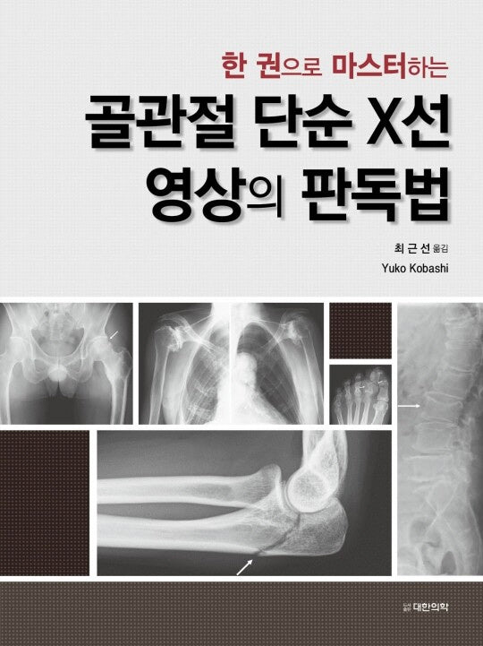 한 권으로 마스터하는 골관절 단순X선 영상의 판독법(양장본 Hardcover)