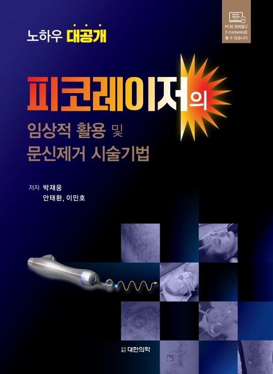 피코레이저의 임상적 활용 및 문신제거 시술기법(양장본 Hardcover)