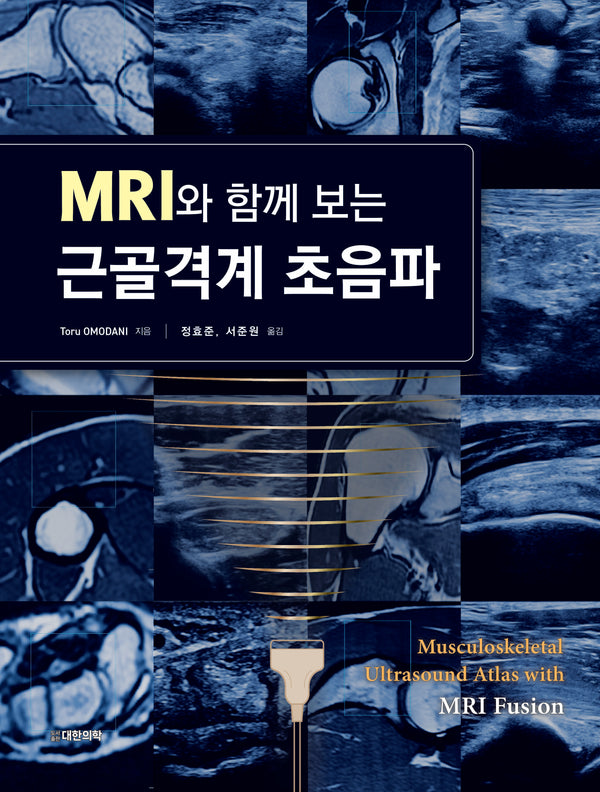 MRI와 함께 보는 근골격계 초음파