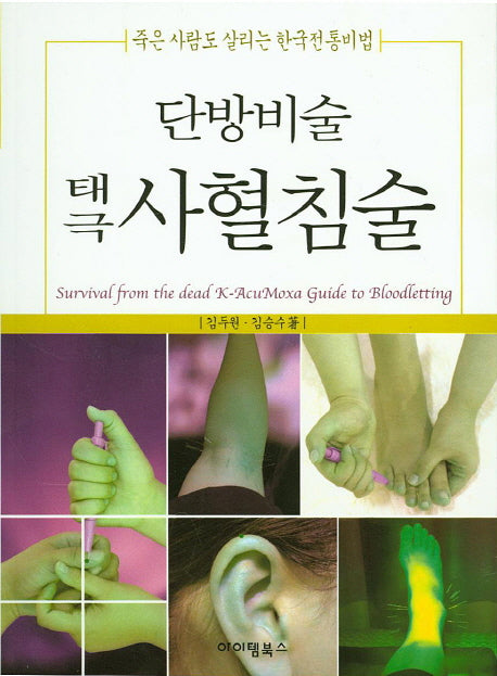 단방비술 태극 사혈침술