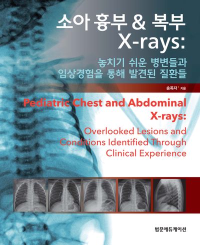 소아 흉부&복부 X-rays: 놓치기 쉬운 병변들과 임상경험을 통해 발견된 질환들(양장본 Hardcover)