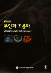 부인과 초음파(2판)(양장본 HardCover)