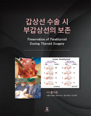 갑상선 수술 시 부갑상선의 보존(양장본 Hardcover)