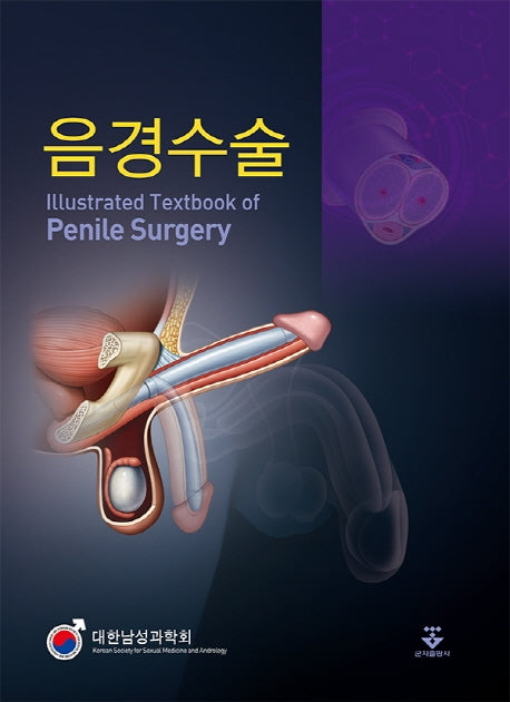 음경수술