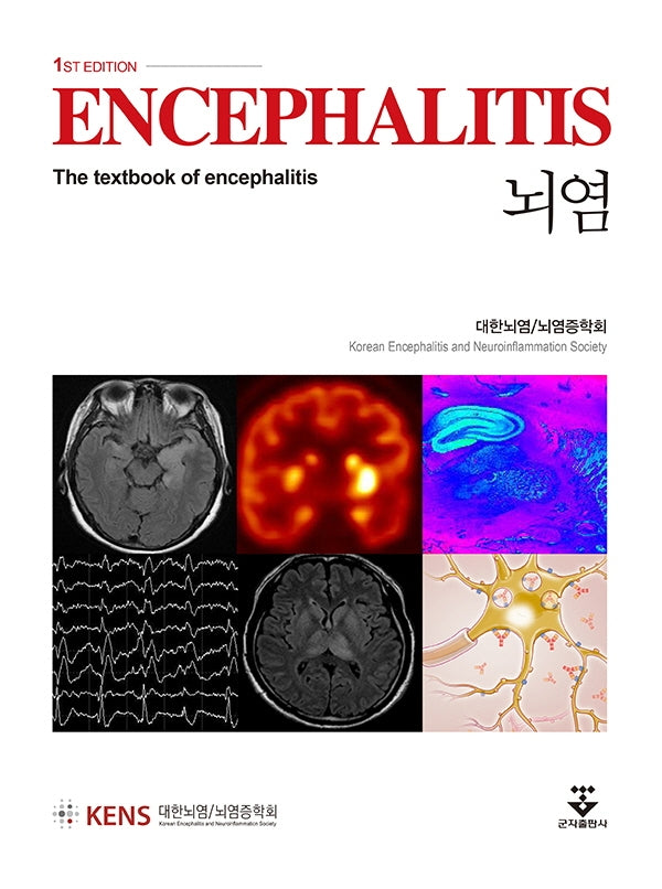뇌염(양장본 Hardcover)
