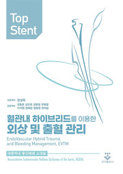 Top Stent